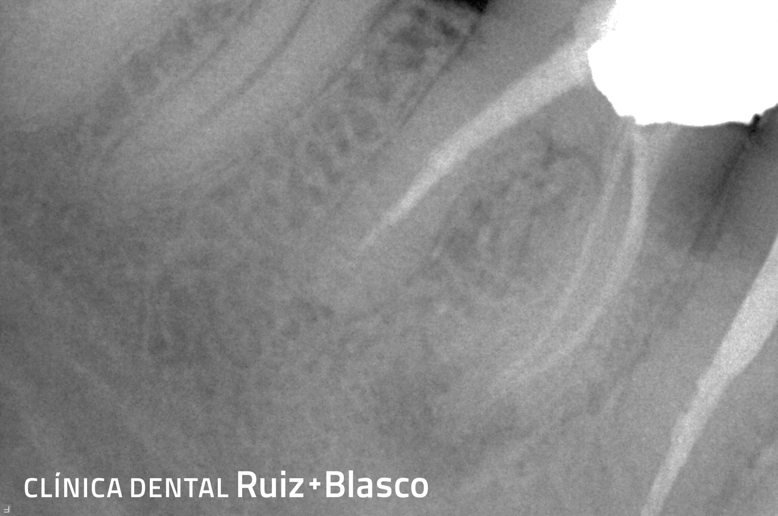 Endodoncia