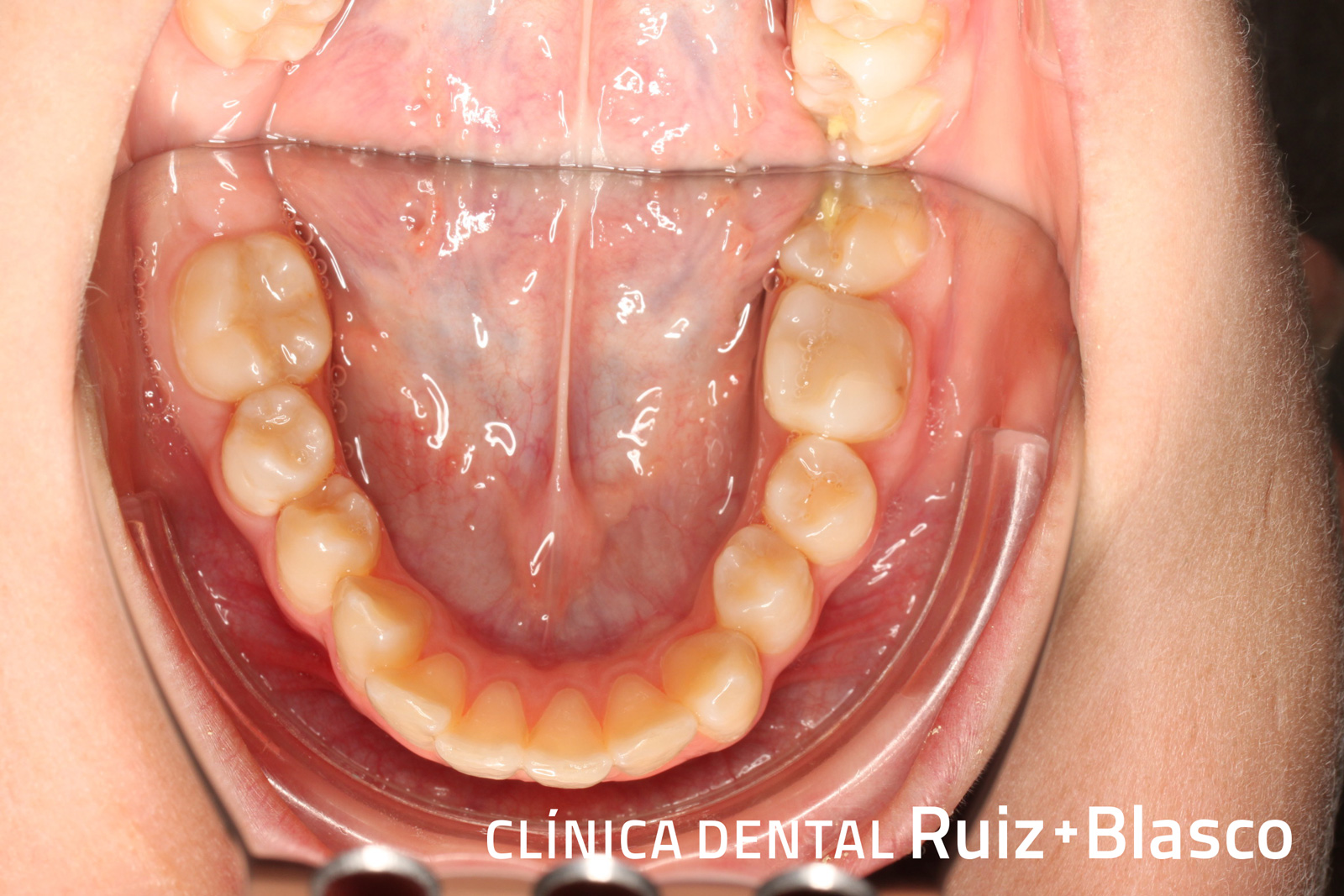 Inicio